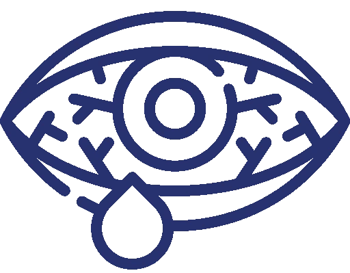 Ümumi Göz Müayinəsi