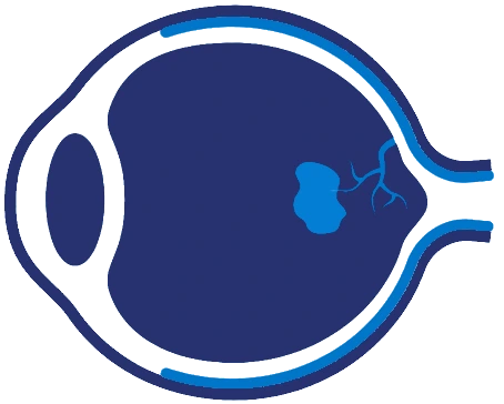 Ümumi Göz Müayinəsi