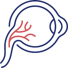 Ümumi Göz Müayinəsi